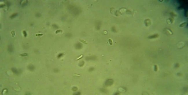Koi-Parasiten_COSTIA