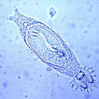 Koi-Kiemensaugwurm_2